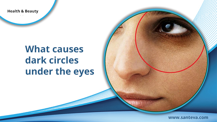 What causes dark circles under the eyes